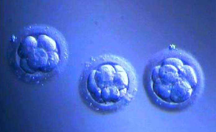 Τεχνικές Υποβοηθούμενης Αναπαραγωγής - Νικόλαος Σκαρτάδος Μαιευτήρας – Χειρουργός Γυναικολόγος, Διδάκτωρ Πανεπιστημίου Αθηνών