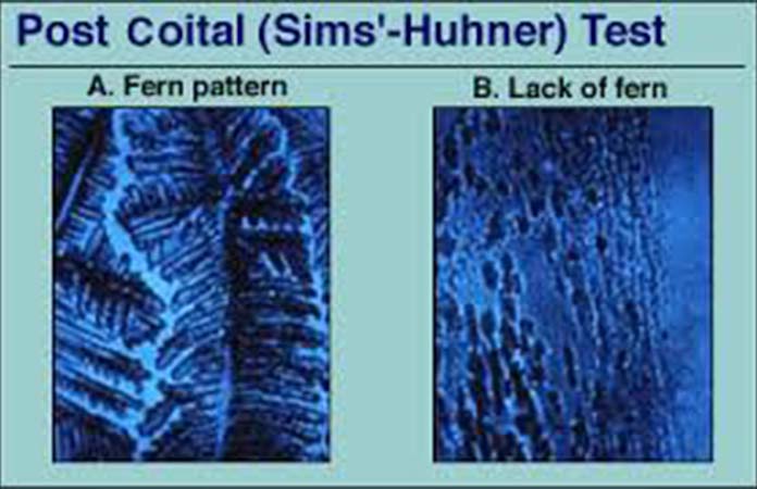 Τεχνικές Υποβοηθούμενης Αναπαραγωγής - Νικόλαος Σκαρτάδος Μαιευτήρας – Χειρουργός Γυναικολόγος, Διδάκτωρ Πανεπιστημίου Αθηνών