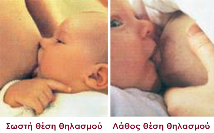 Θηλασμός - Νικόλαος Σκαρτάδος Μαιευτήρας – Χειρουργός Γυναικολόγος, Διδάκτωρ Πανεπιστημίου Αθηνών